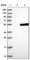 Zinc Finger CCHC-Type Containing 12 antibody, HPA034940, Atlas Antibodies, Western Blot image 