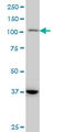 Signal Transducer And Activator Of Transcription 2 antibody, LS-C198277, Lifespan Biosciences, Western Blot image 