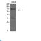 Keratin 4 antibody, LS-C813837, Lifespan Biosciences, Western Blot image 