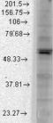 Potassium Voltage-Gated Channel Subfamily J Member 2 antibody, GTX41991, GeneTex, Western Blot image 