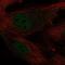 Krueppel-like factor 2 antibody, NBP2-31619, Novus Biologicals, Immunocytochemistry image 