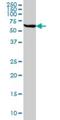 Stress Induced Phosphoprotein 1 antibody, H00010963-M01, Novus Biologicals, Western Blot image 