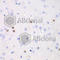 Transketolase antibody, A6314, ABclonal Technology, Immunohistochemistry paraffin image 
