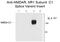 Glutamate Ionotropic Receptor NMDA Type Subunit 1 antibody, GTX82640, GeneTex, Western Blot image 