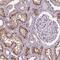 ATPase H+ Transporting V1 Subunit D antibody, NBP2-49254, Novus Biologicals, Immunohistochemistry frozen image 