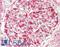 Zinc Finger FYVE-Type Containing 21 antibody, LS-B8842, Lifespan Biosciences, Immunohistochemistry paraffin image 