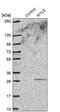 Myosin Light Chain 5 antibody, PA5-57928, Invitrogen Antibodies, Western Blot image 