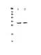 Aquaporin 9 antibody, A03638-1, Boster Biological Technology, Western Blot image 