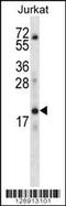 Keratin Associated Protein 13-3 antibody, 56-423, ProSci, Western Blot image 