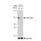 Glycogen Synthase Kinase 3 Alpha antibody, GTX02861, GeneTex, Western Blot image 