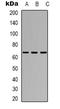 TATA-Box Binding Protein Associated Factor 5 Like antibody, LS-C368810, Lifespan Biosciences, Western Blot image 