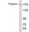 PEAK1 Related, Kinase-Activating Pseudokinase 1 antibody, LS-C199976, Lifespan Biosciences, Western Blot image 