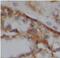 VPS26, Retromer Complex Component A antibody, FNab09432, FineTest, Immunohistochemistry paraffin image 