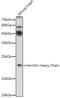 Ferritin Heavy Chain 1 antibody, GTX54014, GeneTex, Western Blot image 