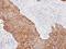 Keratin 14 antibody, GTX104124, GeneTex, Immunohistochemistry paraffin image 