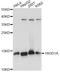 HIG1 Hypoxia Inducible Domain Family Member 1A antibody, A14582, ABclonal Technology, Western Blot image 