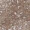 Tensin 2 antibody, NBP1-90698, Novus Biologicals, Immunohistochemistry frozen image 