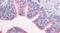 G Protein-Coupled Receptor 87 antibody, PA5-33781, Invitrogen Antibodies, Immunohistochemistry paraffin image 
