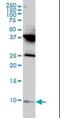 Ribosomal Protein L39 Like antibody, orb89807, Biorbyt, Western Blot image 