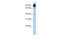 Regulator Of G Protein Signaling 3 antibody, 31-064, ProSci, Enzyme Linked Immunosorbent Assay image 