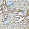 Keratin 14 antibody, 15-857, ProSci, Immunohistochemistry paraffin image 