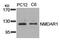 Glutamate Ionotropic Receptor NMDA Type Subunit 1 antibody, GTX50477, GeneTex, Western Blot image 