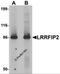 LRR Binding FLII Interacting Protein 2 antibody, 6221, ProSci, Western Blot image 