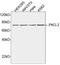 Protein Kinase CGMP-Dependent 2 antibody, LS-B14109, Lifespan Biosciences, Western Blot image 