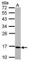Chromosome 17 Open Reading Frame 49 antibody, GTX122496, GeneTex, Western Blot image 