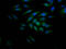 Cyclin E1 antibody, CSB-RA204558A0HU, Cusabio, Immunofluorescence image 