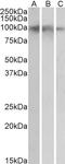 ADAM Metallopeptidase Domain 19 antibody, 43-479, ProSci, Western Blot image 