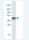 Trehalase antibody, H00011181-M02-100ug, Novus Biologicals, Western Blot image 