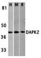 Death-associated protein kinase 2 antibody, orb74424, Biorbyt, Western Blot image 