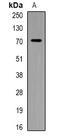 Phosphatidylinositol-4-Phosphate 5-Kinase Type 1 Alpha antibody, abx142030, Abbexa, Western Blot image 