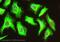 G Protein-Coupled Receptor Kinase 5 antibody, ab64943, Abcam, Immunofluorescence image 