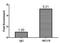 Negative Elongation Factor Complex Member B antibody, LS-C211610, Lifespan Biosciences, Chromatin Immunoprecipitation image 