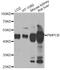 Peptidase, Mitochondrial Processing Beta Subunit antibody, A12549, ABclonal Technology, Western Blot image 