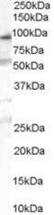 Oxysterol Binding Protein Like 10 antibody, GTX89470, GeneTex, Western Blot image 