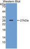 Frizzled Class Receptor 1 antibody, LS-C374819, Lifespan Biosciences, Western Blot image 