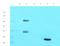Complement Component 4 Binding Protein Beta antibody, orb341049, Biorbyt, Western Blot image 