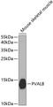 Parvalbumin antibody, 18-815, ProSci, Western Blot image 