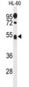 Sialophorin antibody, abx034446, Abbexa, Western Blot image 