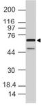 SAM And HD Domain Containing Deoxynucleoside Triphosphate Triphosphohydrolase 1 antibody, A00592, Boster Biological Technology, Western Blot image 