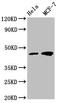 Tumor Susceptibility 101 antibody, CSB-MA860355A0m, Cusabio, Western Blot image 