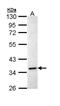 Inhibin Subunit Alpha antibody, PA5-29231, Invitrogen Antibodies, Western Blot image 