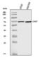 Choline O-Acetyltransferase antibody, A01192-6, Boster Biological Technology, Western Blot image 