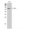 Interleukin 10 Receptor Subunit Alpha antibody, LS-C387723, Lifespan Biosciences, Western Blot image 