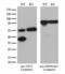Twinfilin Actin Binding Protein 1 antibody, LS-C794608, Lifespan Biosciences, Western Blot image 