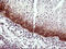 Interleukin 6 Receptor antibody, LS-C797753, Lifespan Biosciences, Immunohistochemistry paraffin image 