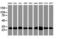 Proteasome Subunit Alpha 6 antibody, LS-C175133, Lifespan Biosciences, Western Blot image 